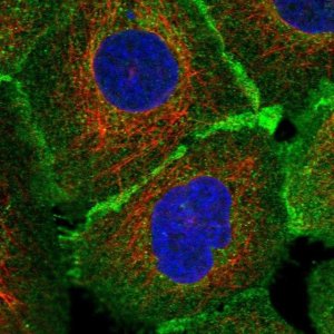 Anti-TCAF2 antibody produced in rabbit 