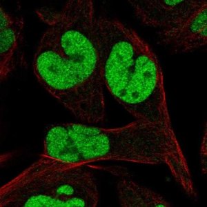 Anti-TCEAL1 antibody produced in rabbit 