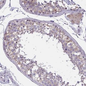 Anti-TCEAL8 antibody produced in rabbit 