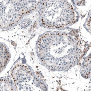 Anti-TCF3 antibody produced in rabbit 