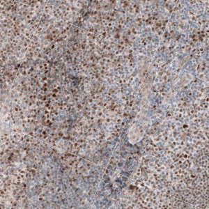 Anti-TCF3 antibody produced in rabbit 