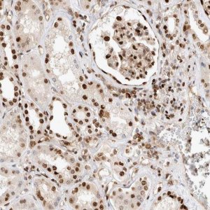 Anti-TCF4 antibody produced in rabbit 