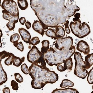 Anti-TCHH antibody produced in rabbit 