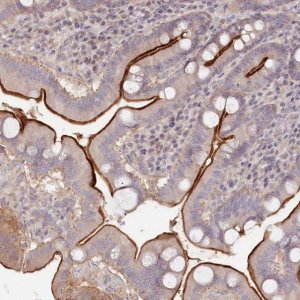 Anti-TCHP antibody produced in rabbit 
