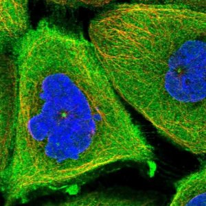 Anti-TCHP antibody produced in rabbit 
