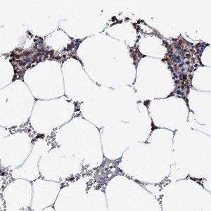 Anti-TCIRG1 antibody produced in rabbit 