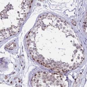Anti-TCOF1 antibody produced in rabbit 