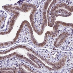 Anti-TCOF1 antibody produced in rabbit 