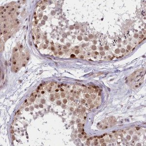 Anti-TCOF1 antibody produced in rabbit HPA038238-100UL