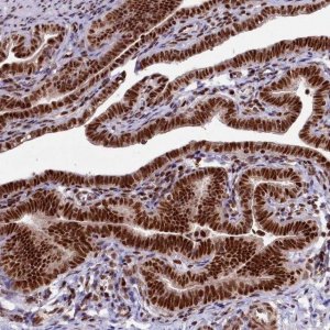 Anti-TCOF1 antibody produced in rabbit HPA038238-100UL