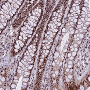 Anti-TCP11L2 antibody produced in rabbit 