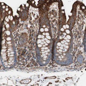 Anti-TCTA antibody produced in rabbit 