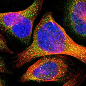 Anti-TCTA antibody produced in rabbit 