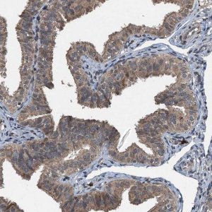Anti-TCTN1 antibody produced in rabbit 