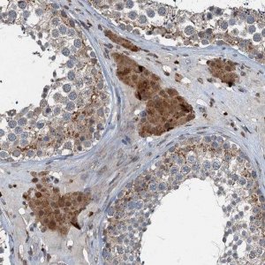 Anti-TCTN1 antibody produced in rabbit 