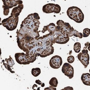 Anti-TCTN1 antibody produced in rabbit HPA040036-100UL