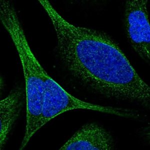 Anti-TCTN3 antibody produced in rabbit 