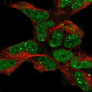 Anti-TDP2 antibody produced in rabbit 