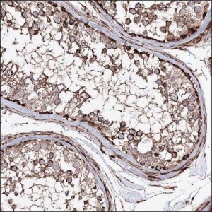 Anti-TDRD1 antibody produced in rabbit HPA037730-100UL
