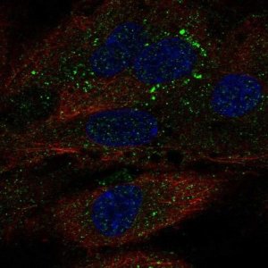 Anti-TDRD10 antibody produced in rabbit 