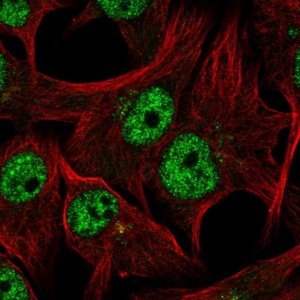 Anti-TDRD3 antibody produced in rabbit 