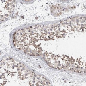 Anti-TDRD7 antibody produced in rabbit 