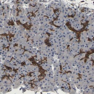 Anti-TDRKH antibody produced in rabbit 