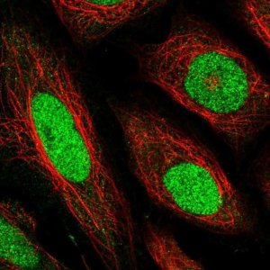 Anti-TEAD1 antibody produced in rabbit 