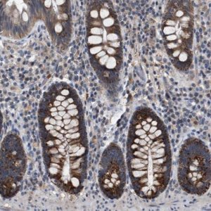 Anti-TECPR1 antibody produced in rabbit 