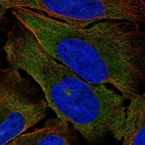Anti-TEK antibody produced in rabbit 