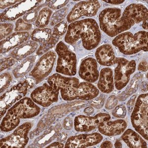 Anti-TELO2 antibody produced in rabbit 