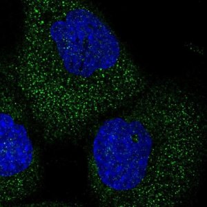 Anti-TELO2 antibody produced in rabbit 