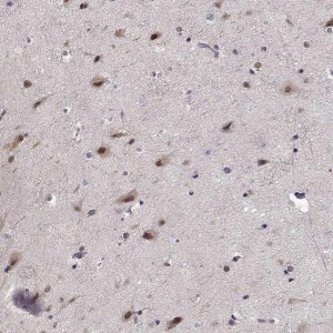 Anti-TESPA1 antibody produced in rabbit 