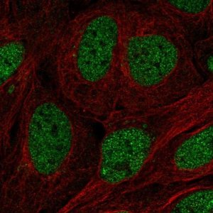 Anti-TFCP2 antibody produced in rabbit HPA070247-100UL