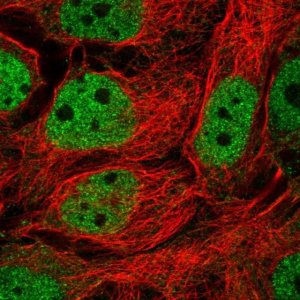 Anti-TFEB antibody produced in rabbit 
