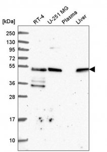 Anti-TFG antibody produced in rabbit 
