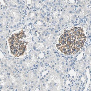 Anti-TGFBR3 antibody produced in rabbit 