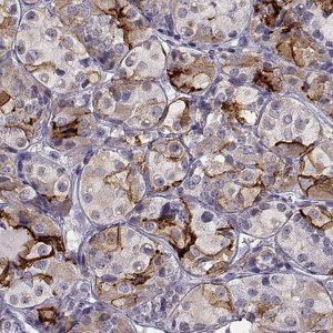 Anti-TGFBR3L antibody produced in rabbit 