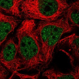 Anti-TGIF2 antibody produced in rabbit 