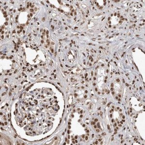 Anti-TGS1 antibody produced in rabbit HPA025024-100UL