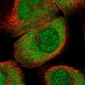 Anti-TGS1 antibody produced in rabbit HPA025024-100UL