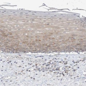 Anti-THADA antibody produced in rabbit 