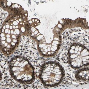 Anti-THAP12 antibody produced in rabbit 