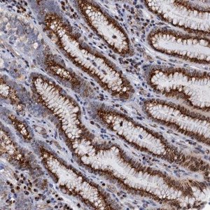 Anti-THAP2 antibody produced in rabbit 