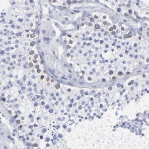 Anti-THAP7 antibody produced in rabbit 