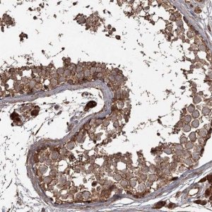 Anti-THAP9 antibody produced in rabbit 