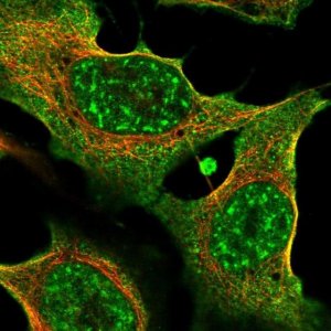 Anti-THBS2 antibody produced in rabbit 