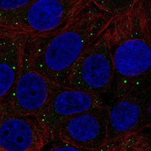 Anti-THBS3 antibody produced in rabbit 