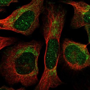 Anti-THNSL1 antibody produced in rabbit 