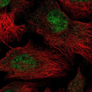 Anti-THOC5 antibody produced in rabbit 